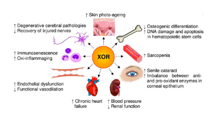 Evaluation of oxidative status with xanthine oxidoreductase activities in postmenopausal Iraqi osteoporosis women 